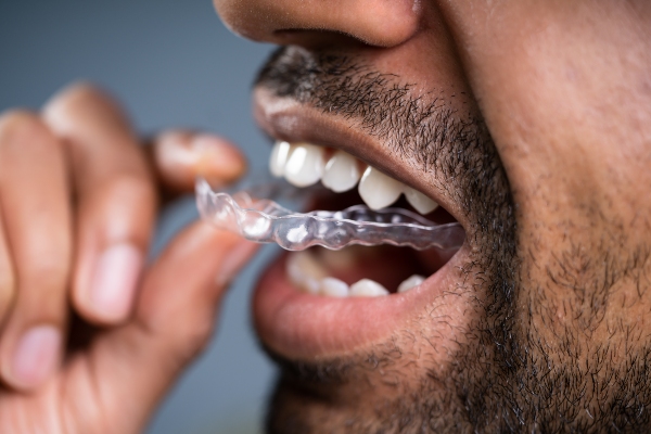 Exploring Your Orthodontics Options