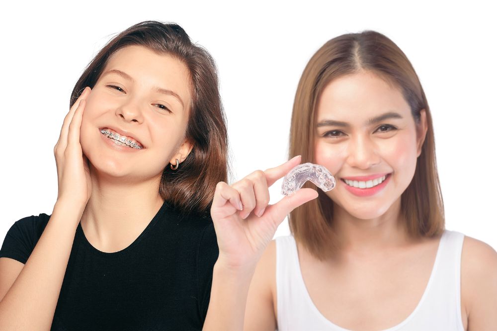 Braces Vs  Invisalign: Which Is Best For Teens And Adults?