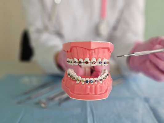 Metal Braces: A Reliable Treatment For Adult Orthodontics