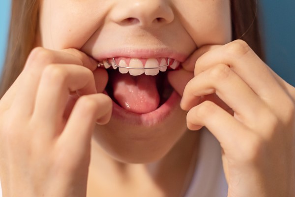 An Orthodontist Can Help Improve Speech, Chewing, And Biting Through Bite Correction