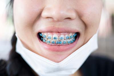 Can An Orthodontist Fix My Smile?