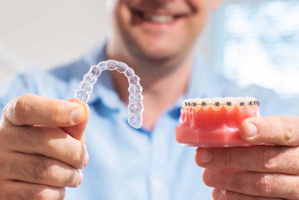 Teeth Straightening Treatment Alternatives To Braces