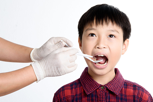 When A Pediatric Dentist May Recommend Dental Sealants